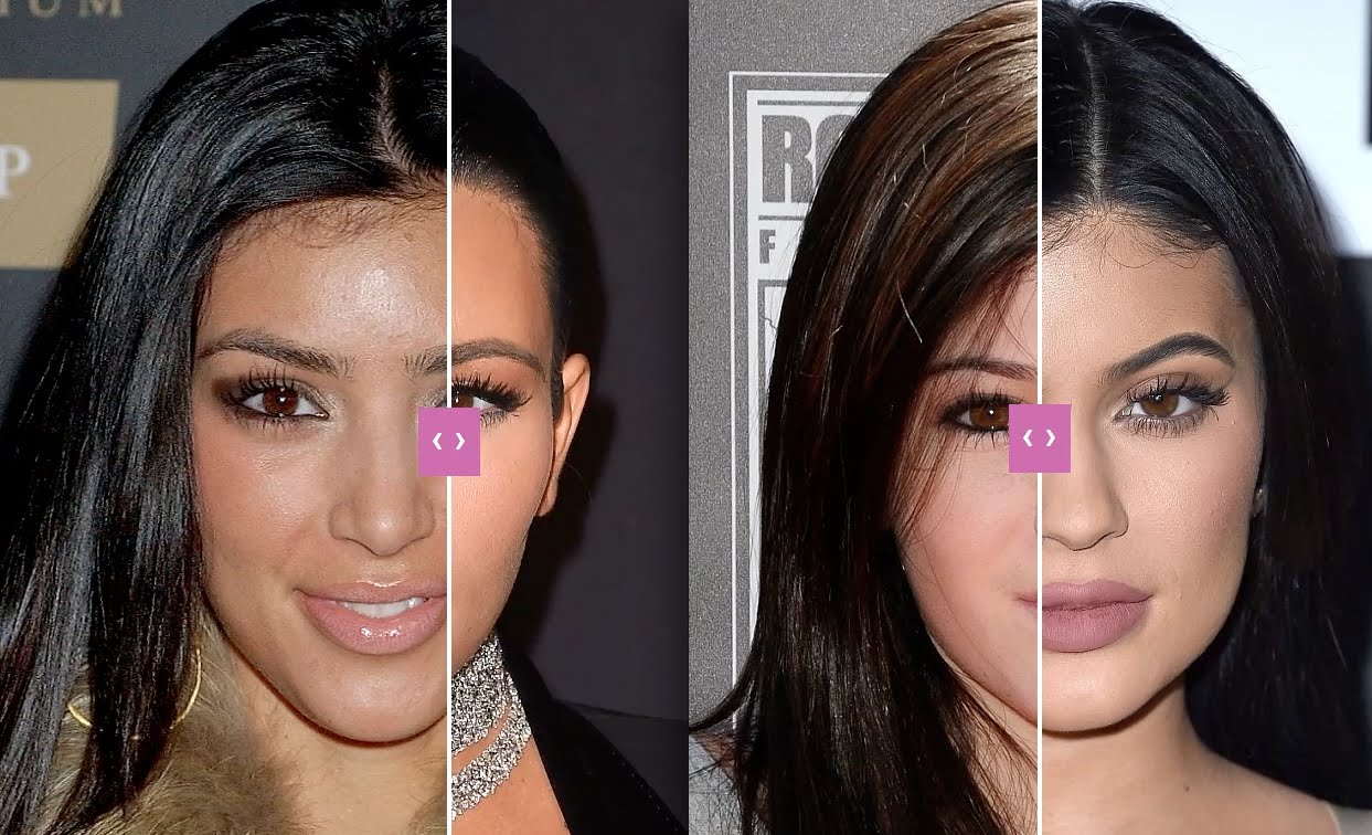 kim-kardashian-before-plastic-surgeon-1.jpg.